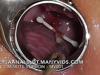 FreyjaAnalslut's medical journey: IUD removal and fertility on ManyVids